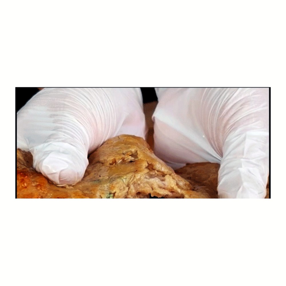 노랑 곱빼기 왕 떡갈비, 160g, 5봉